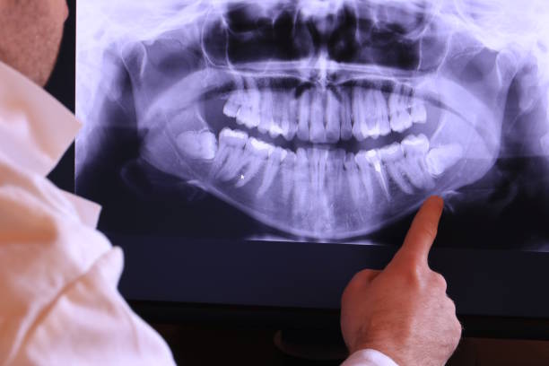 Best Tooth Infection Emergency Dentist  in Moorefield, WV