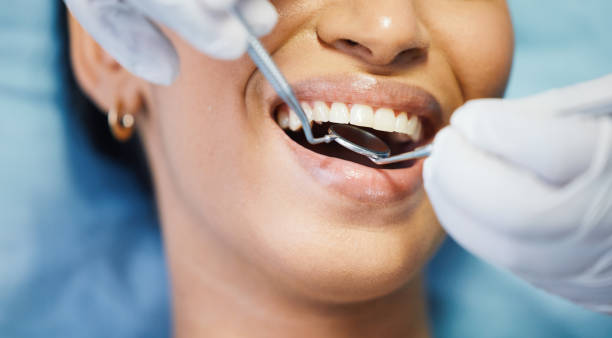 Best Teeth Whitening  in Moorefield, WV